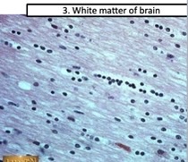 What type of glial cells?