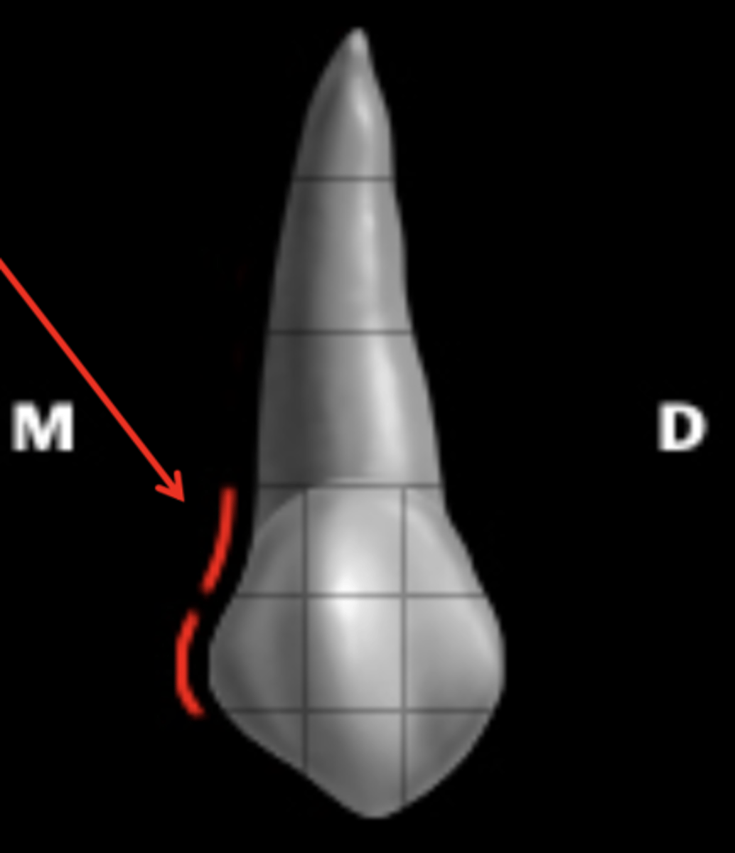 <p>concave</p>