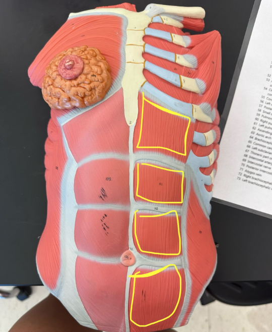 <p>What muscle is the yellow line indicating?</p>