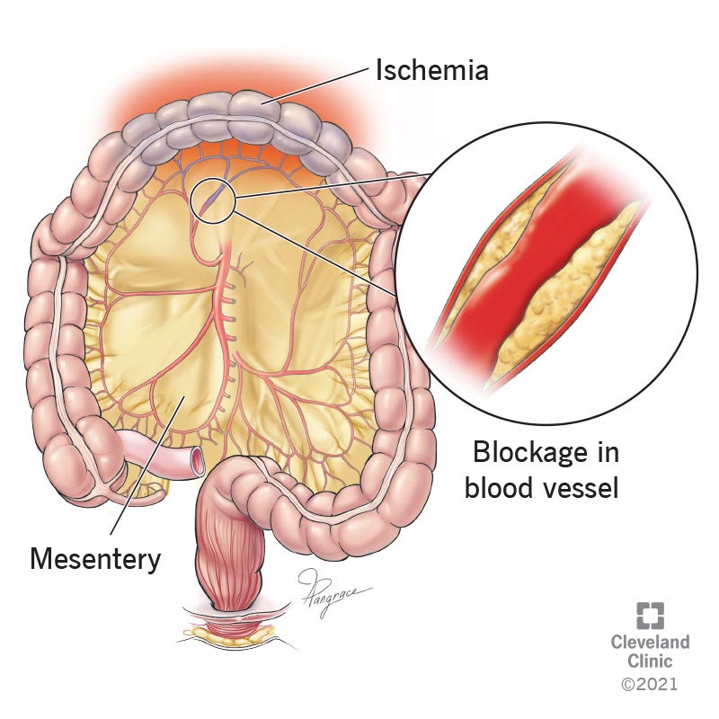 <p>a continuous fold of tissue that attaches the intestines to the posterior abdominal wall, serving to anchor them in place and prevent them from collapsing or tangling; functions to provide structural support and a pathway for blood vessels, nerves, and lymphatics to supply the digestive organs.</p>