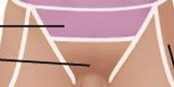 <p>Anterior Axial Region- Pelvic</p>