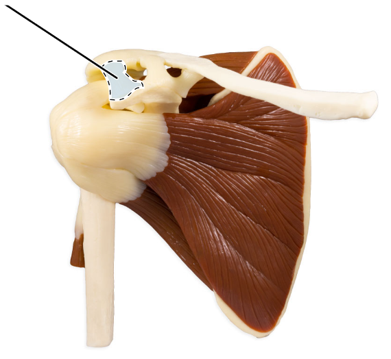 <p>What ligament is highlighted here?</p>