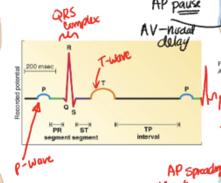 <p>D. Ventricular depolarization</p>
