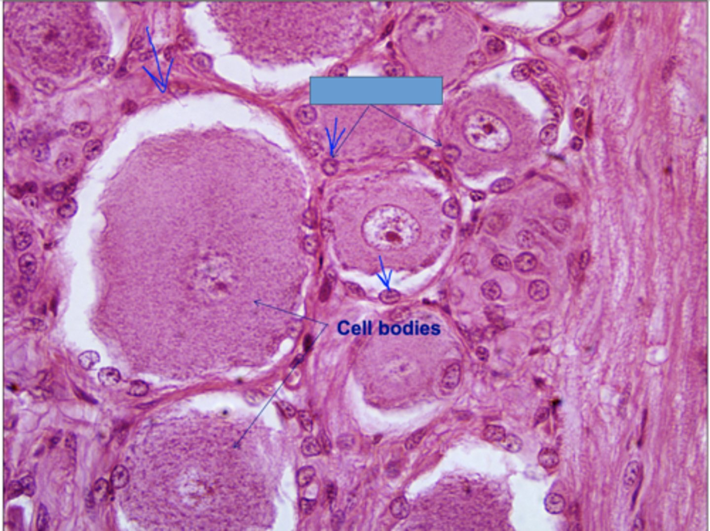 <p>Identify the cells</p>