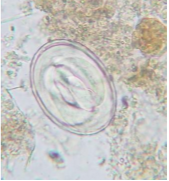 <p>Swine lungworm</p>