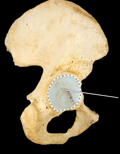 <p>Hip bone, lateral view, right ilium</p>