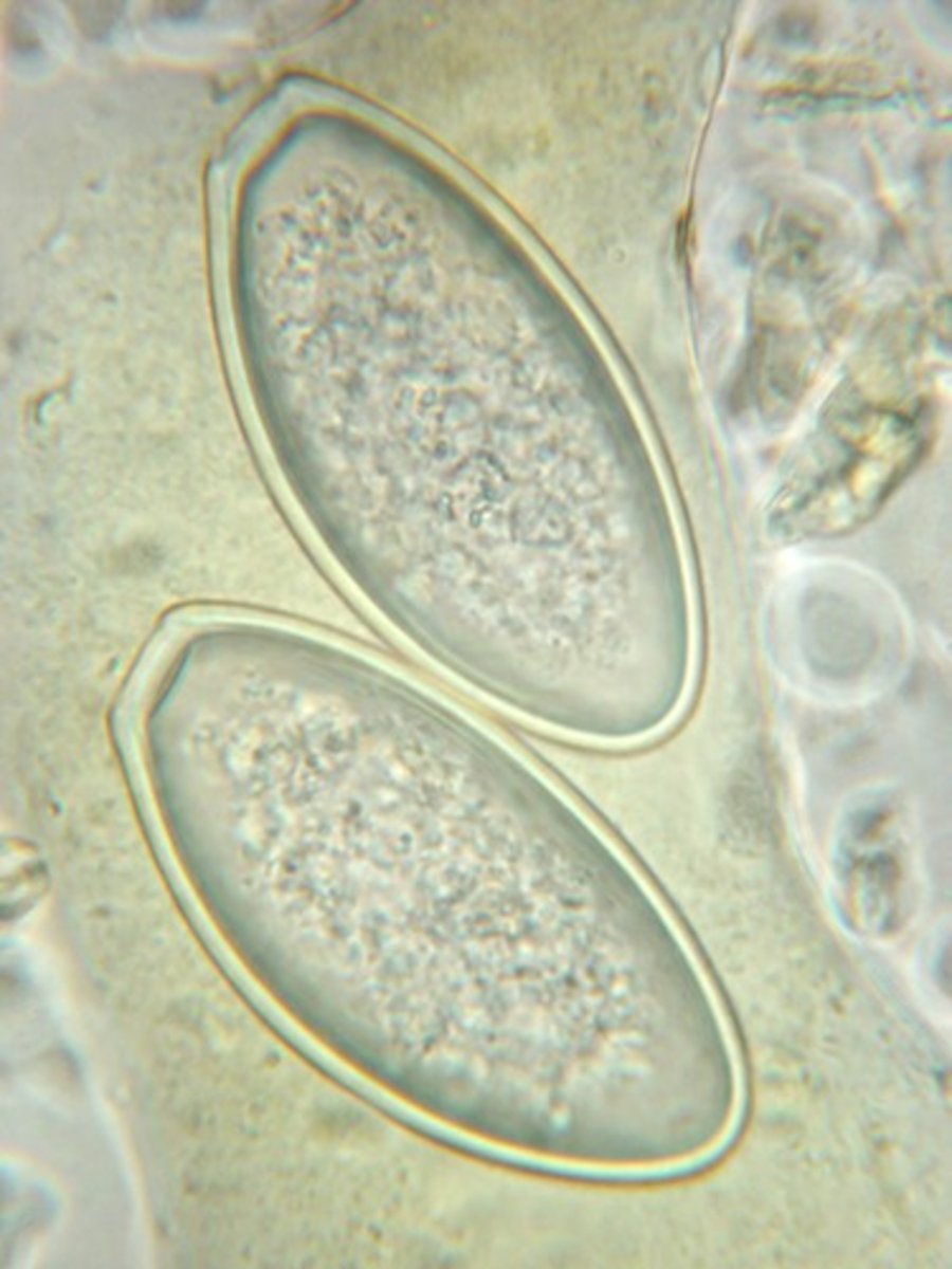 <p>What parasite is responsible for these eggs measuring approximately 90x 42 um recovered from the "scotch tape" preparation made from the perianal surface of a 15 year-old mare?</p>