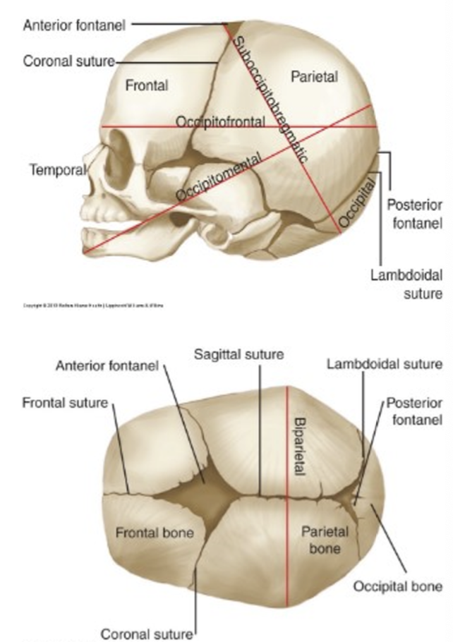 <ul><li><p>face and cranial base are fixed</p></li><li><p>cranial vault, which has sutures, is moldable</p></li><li><p>fontanelle: intersection of sutures </p></li></ul>