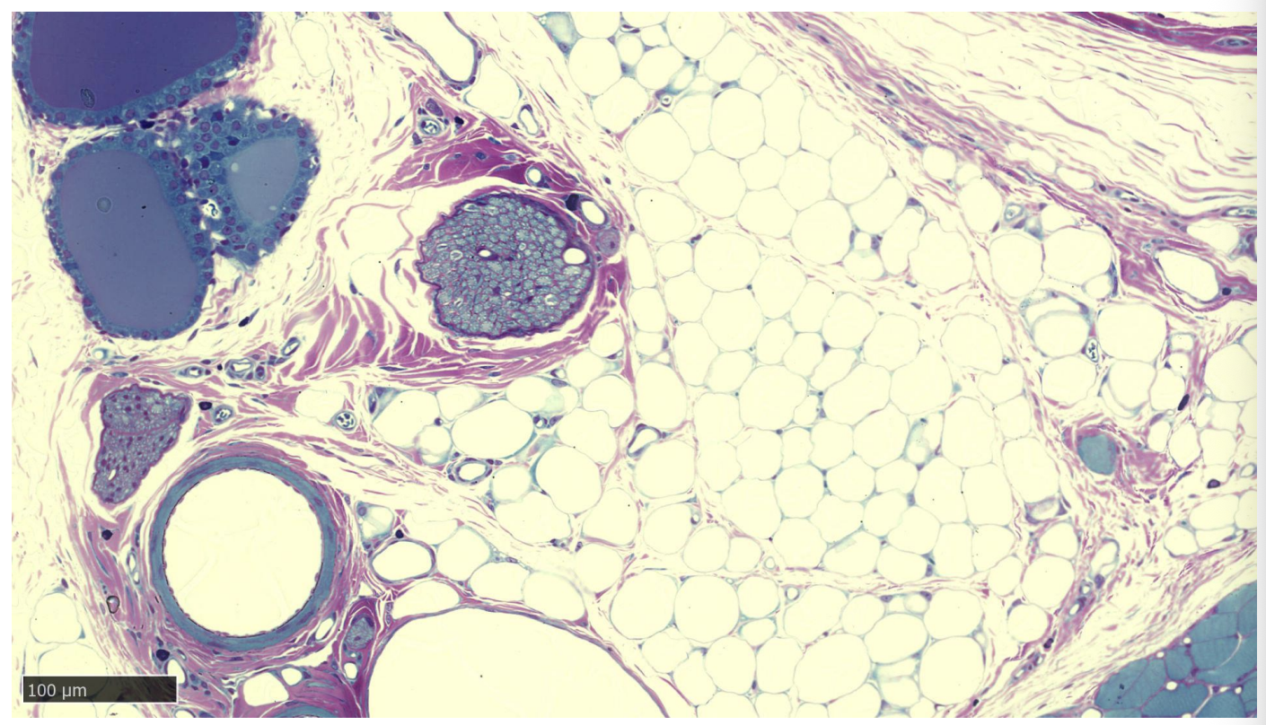 <ul><li><p>Epithlia?</p></li></ul><p></p>