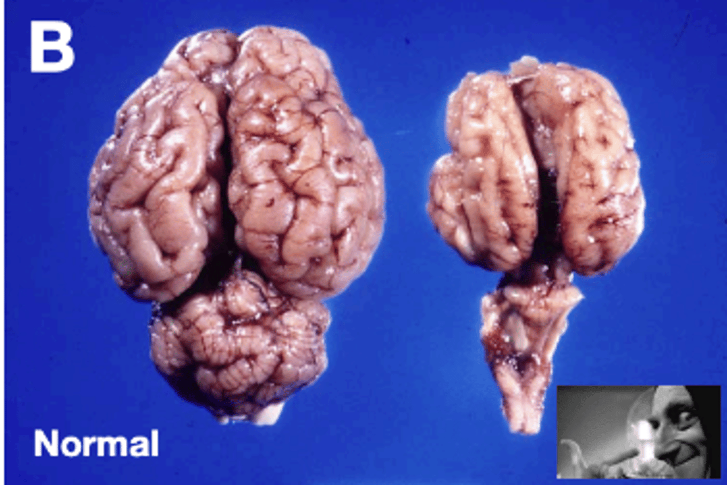 <p>- Small brain</p>