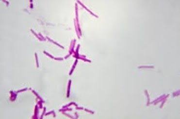 <p><br><span>The diagrams below show a bacterium. &nbsp;Why is it considered a prokaryote?</span></p><p><span>it has in irregular shape.</span></p><p><span>it doesn't have a nucleus</span></p><p>&nbsp;<span>it has a nucleus.</span></p><p><span>it has DNA</span></p>