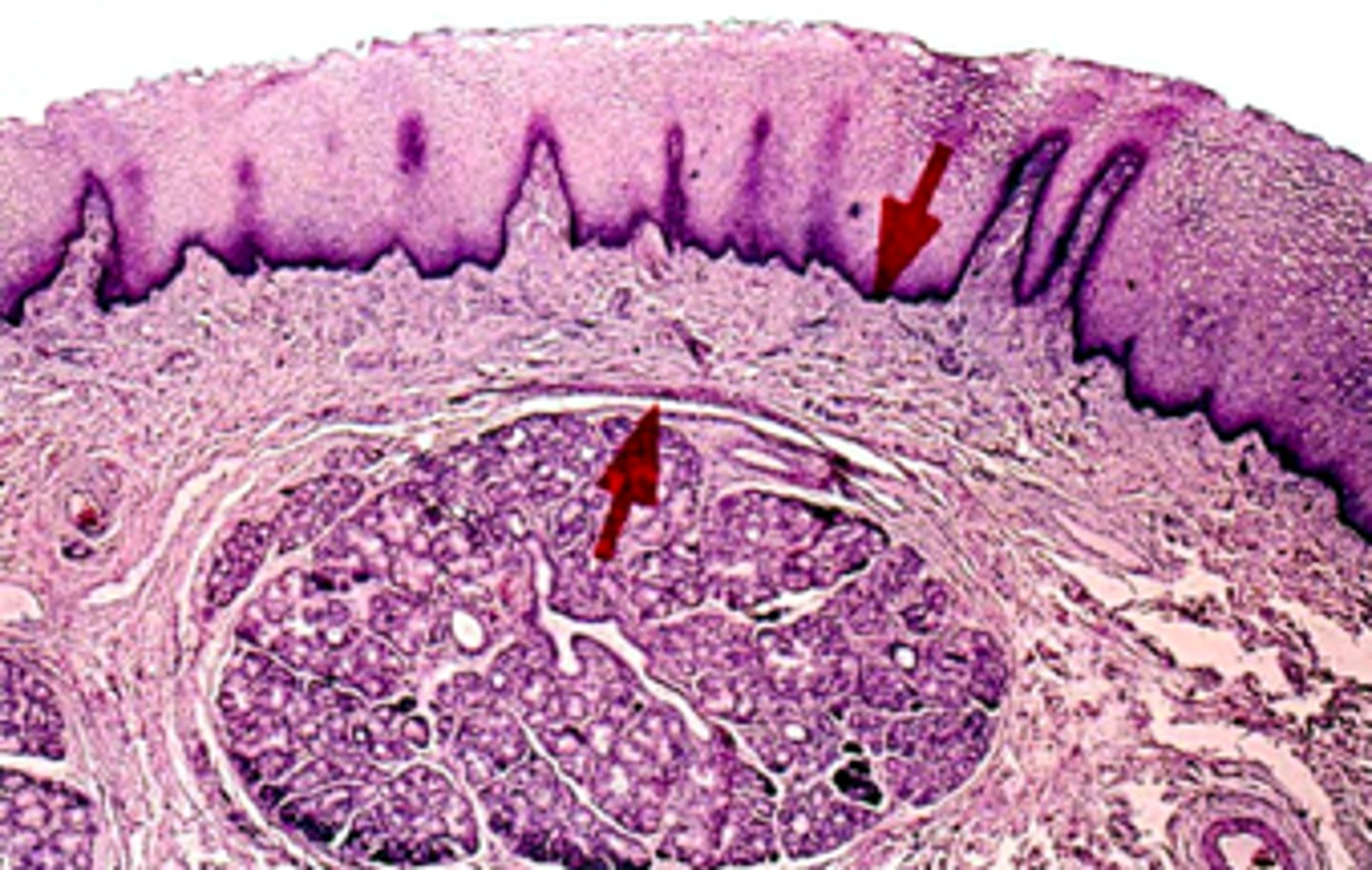 <p><em>what part of the labial mucosa is this:</em></p>