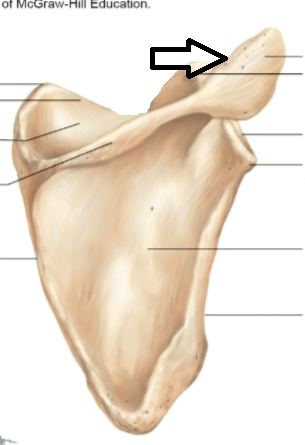 <p>what part of the scapula is this?</p>