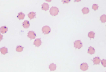 <p><span style="color: rgb(255, 255, 255);"><span>what does Anaplasma spp.; A. marginale infect</span></span></p>