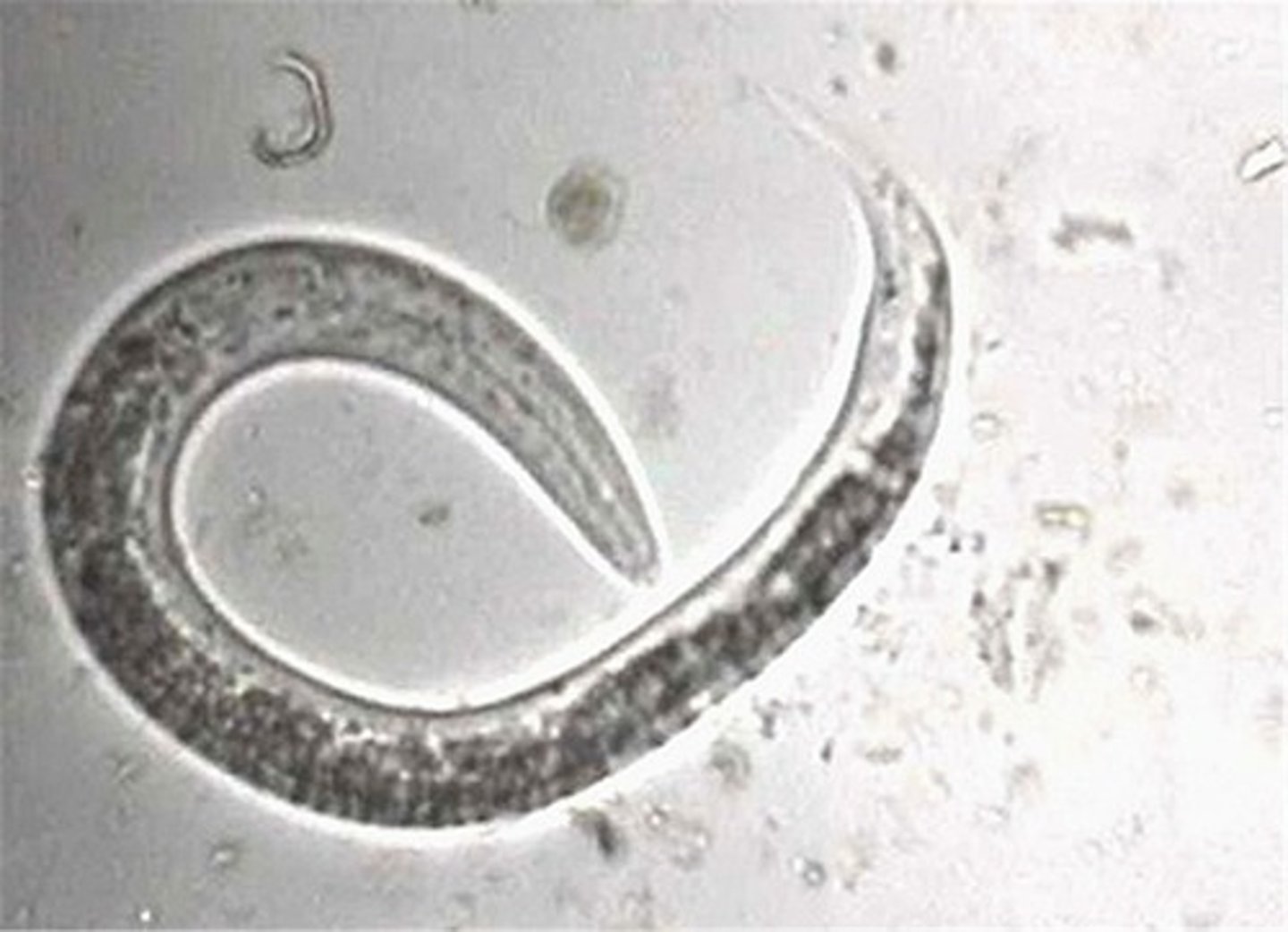 <p>This was found via the Baermann Technique in a stool sample of a coughing cow. What is it?</p>
