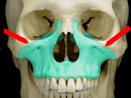 <p>articulates with zygomatic bone</p>