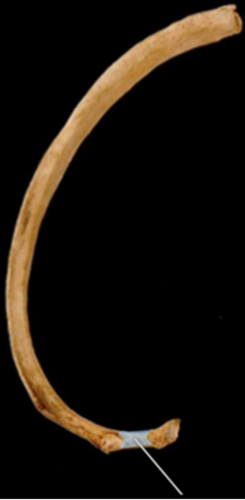 Which of the following ligaments attaches to the highlighted structure?