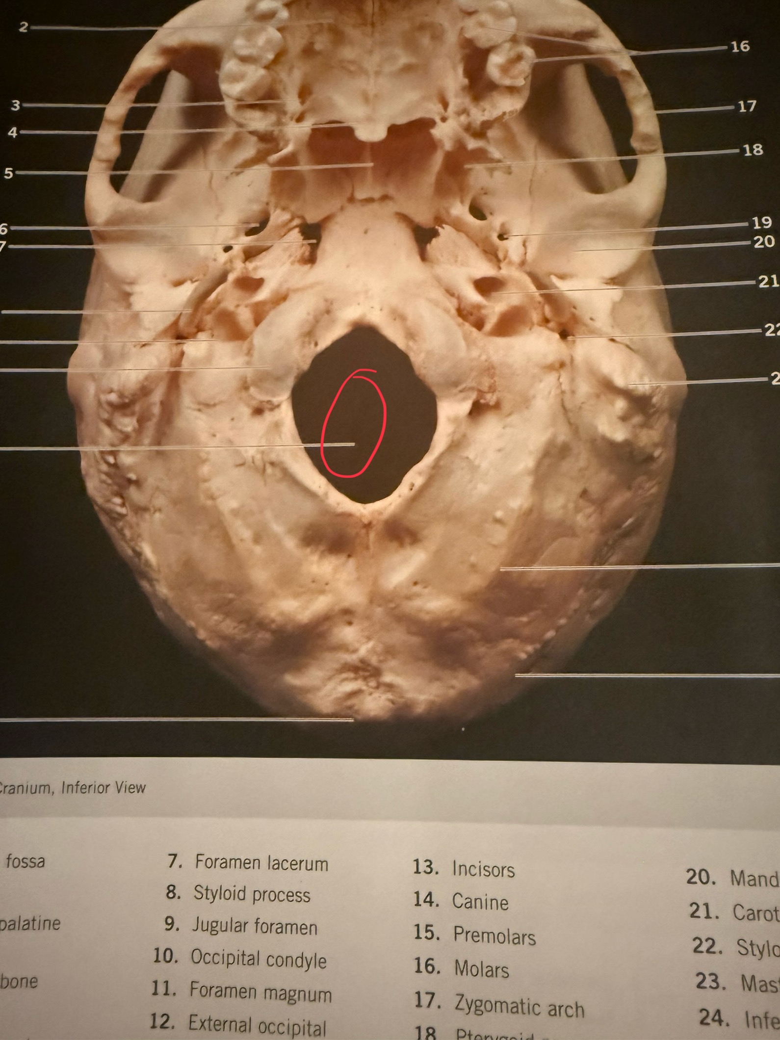 term image