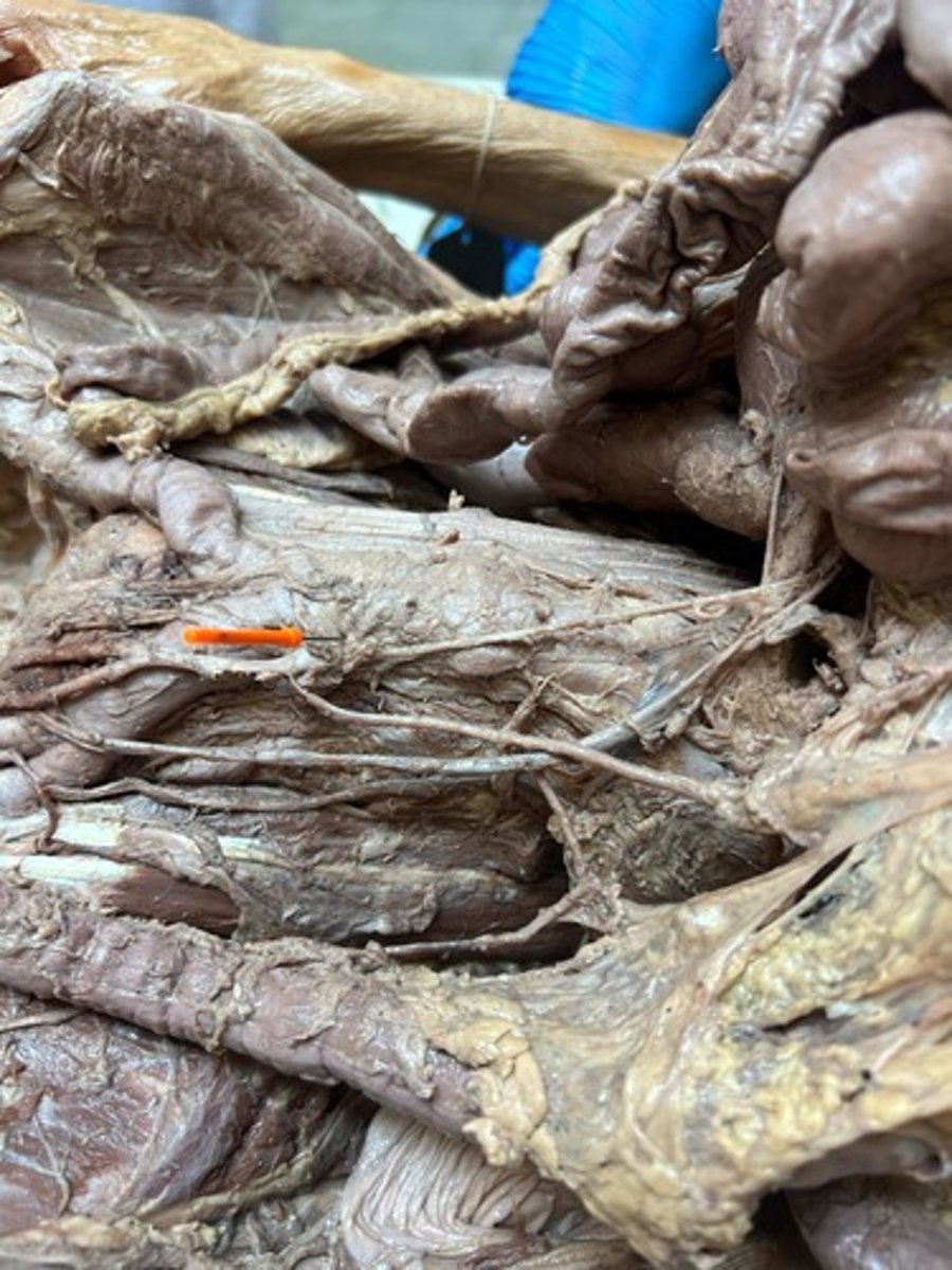 <p>l.colic artery</p>