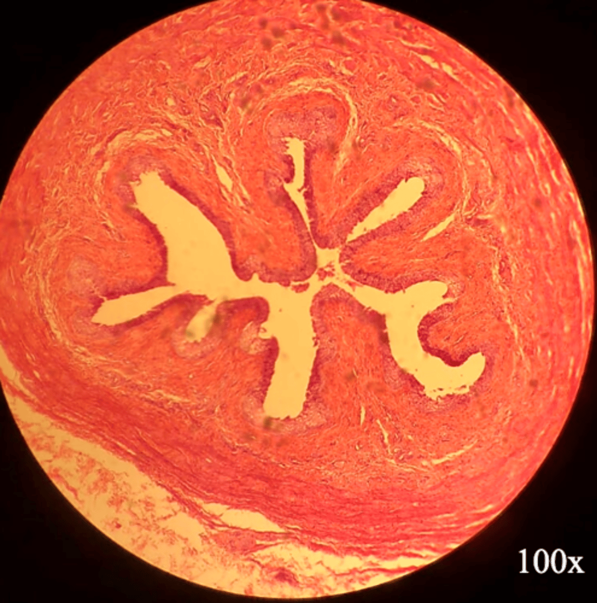 <p>Where can this tissue be found?</p>