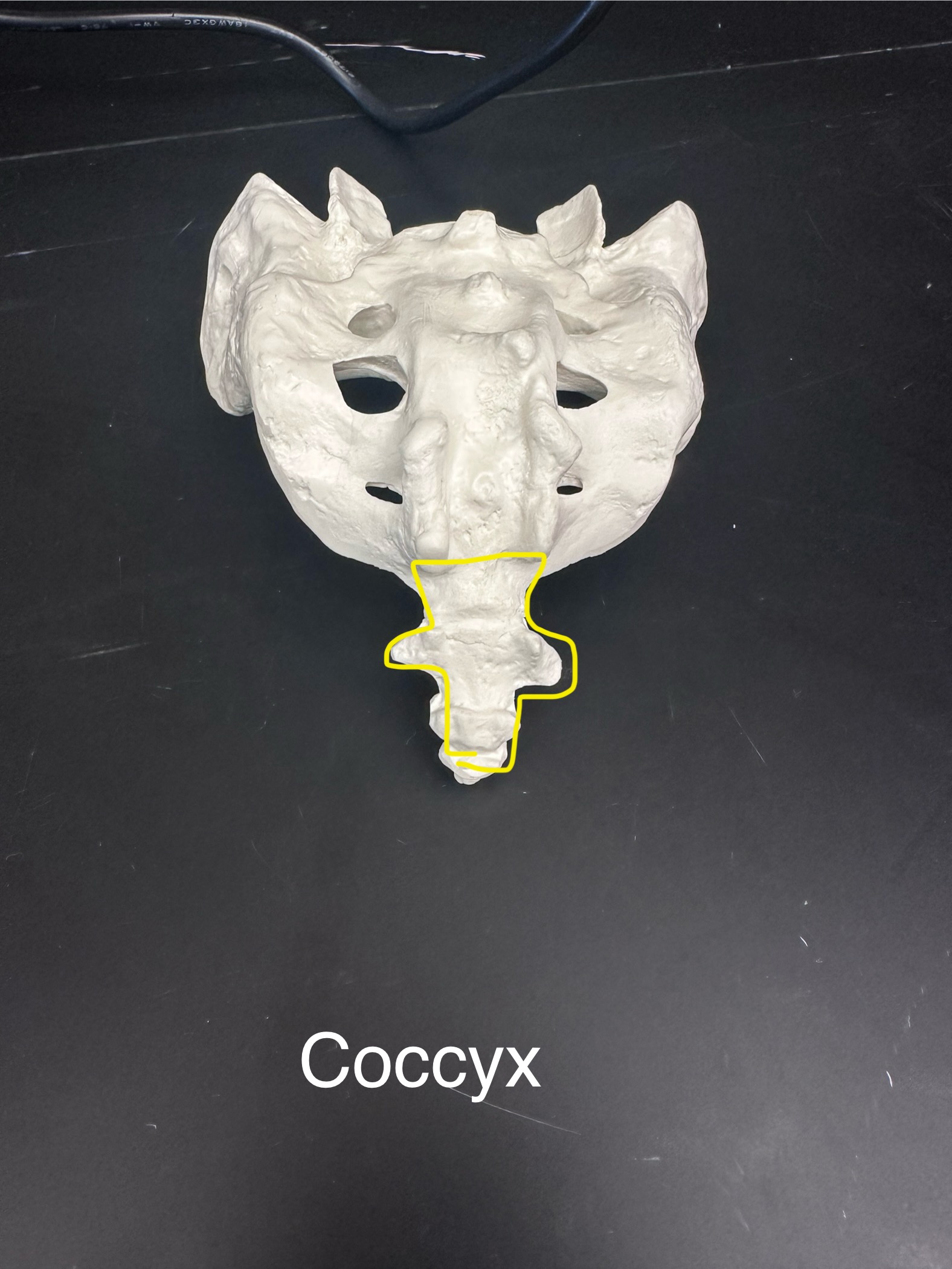 <p>Coccyx</p>