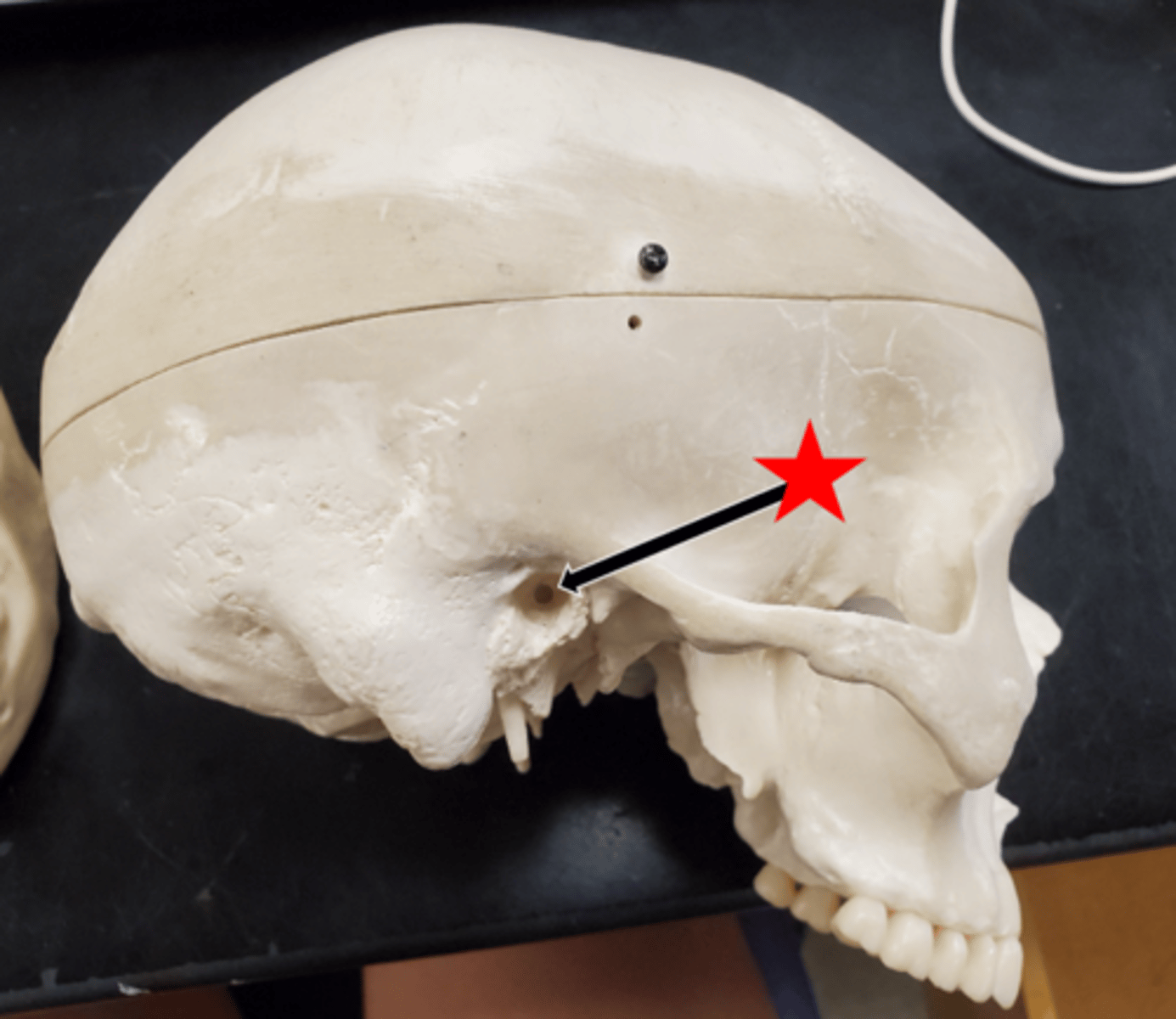 <p>Name the starred region in the image.</p>