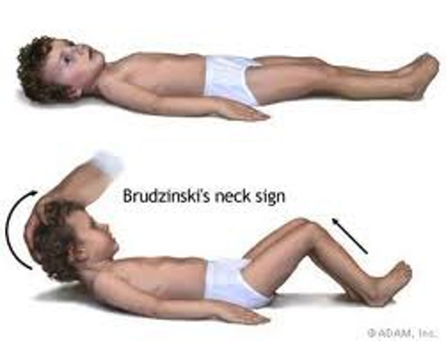 <p>Flexion of the knees and hips occurring with deliberate flexion of the client's neck</p>