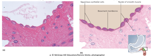 <p>-sinlge row of thin cells</p><p>-permits rapid diffusion or transport of substances</p><p>-secretes serous fluid</p><p>-locations: alveoli, glomeruli, endothelium, and serosa</p>
