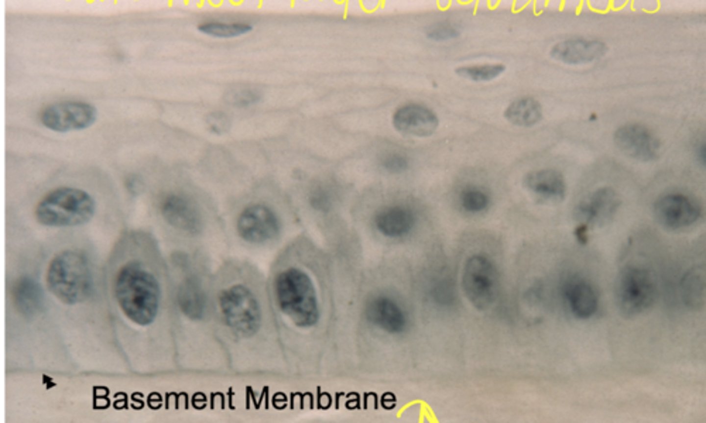 <p>what type of epithelium is shown</p>
