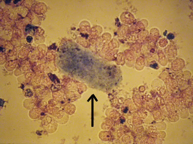 <ol><li><p>Identify pointed structure.</p></li><li><p>What organisms is this structure mainly made up of?</p></li></ol><p></p>