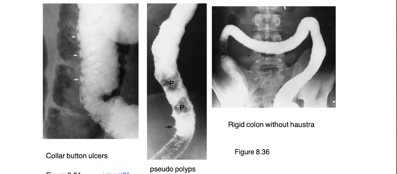 <p>What is this diagnosis?</p>