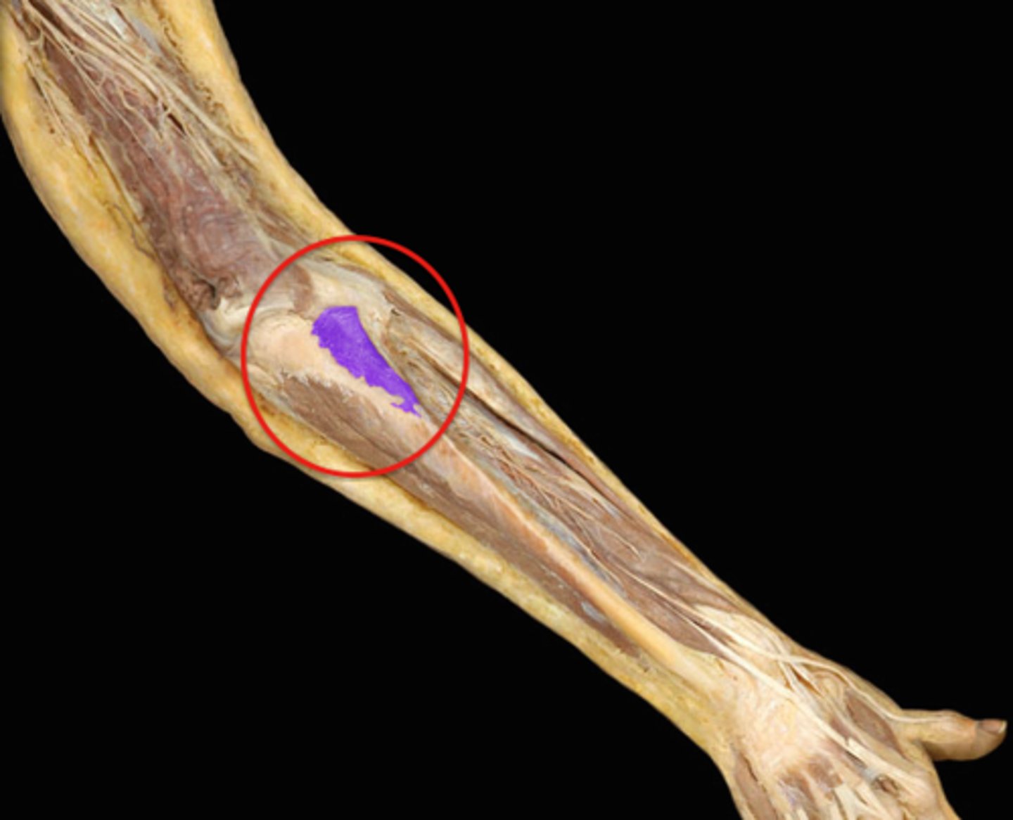 <p>What is this muscle, and what is its action, Proximal &amp; Distal insertions?</p>