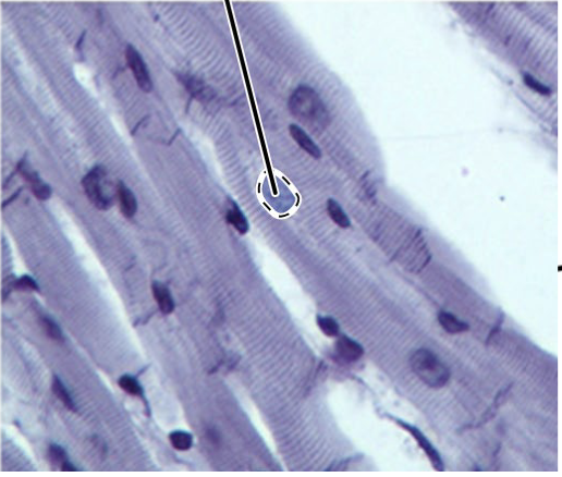 <p>What is the arrow point at?</p>