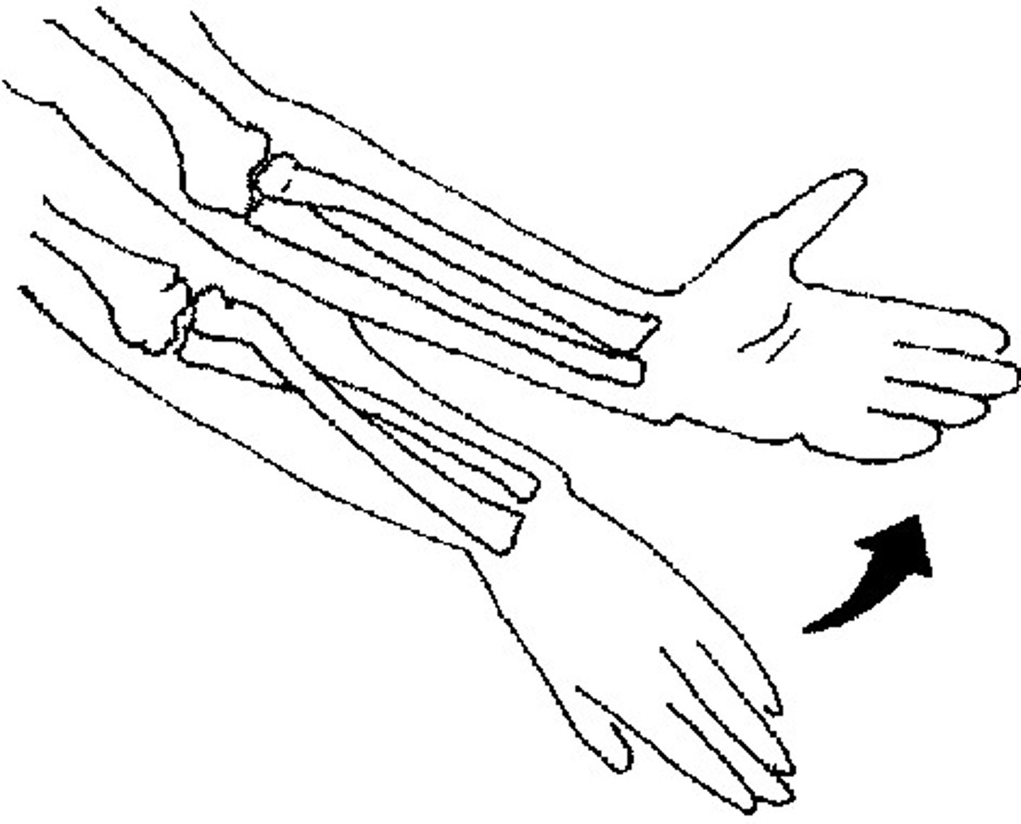 <p>Rotating forearm so palm faces anteriorly or superiorly (palm up; "hold a bowl of soup")</p>
