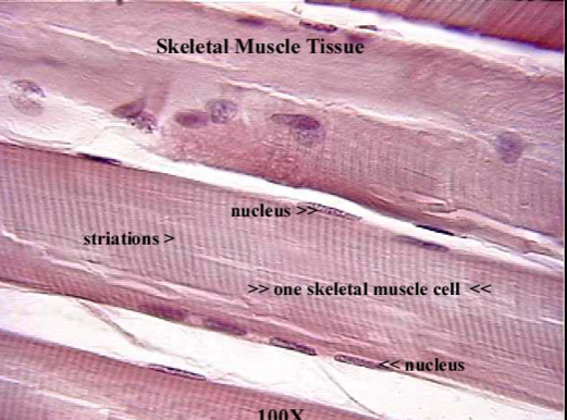 <p>striated &amp; tubular</p><p><strong>many</strong> nuclei</p><p>contract <strong>voluntarily</strong></p><p>attached to bones of skeleton and eyelids</p>