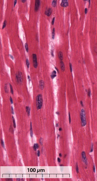 <p>What type of muscle is this and how do you know? (longitudinal section)</p>