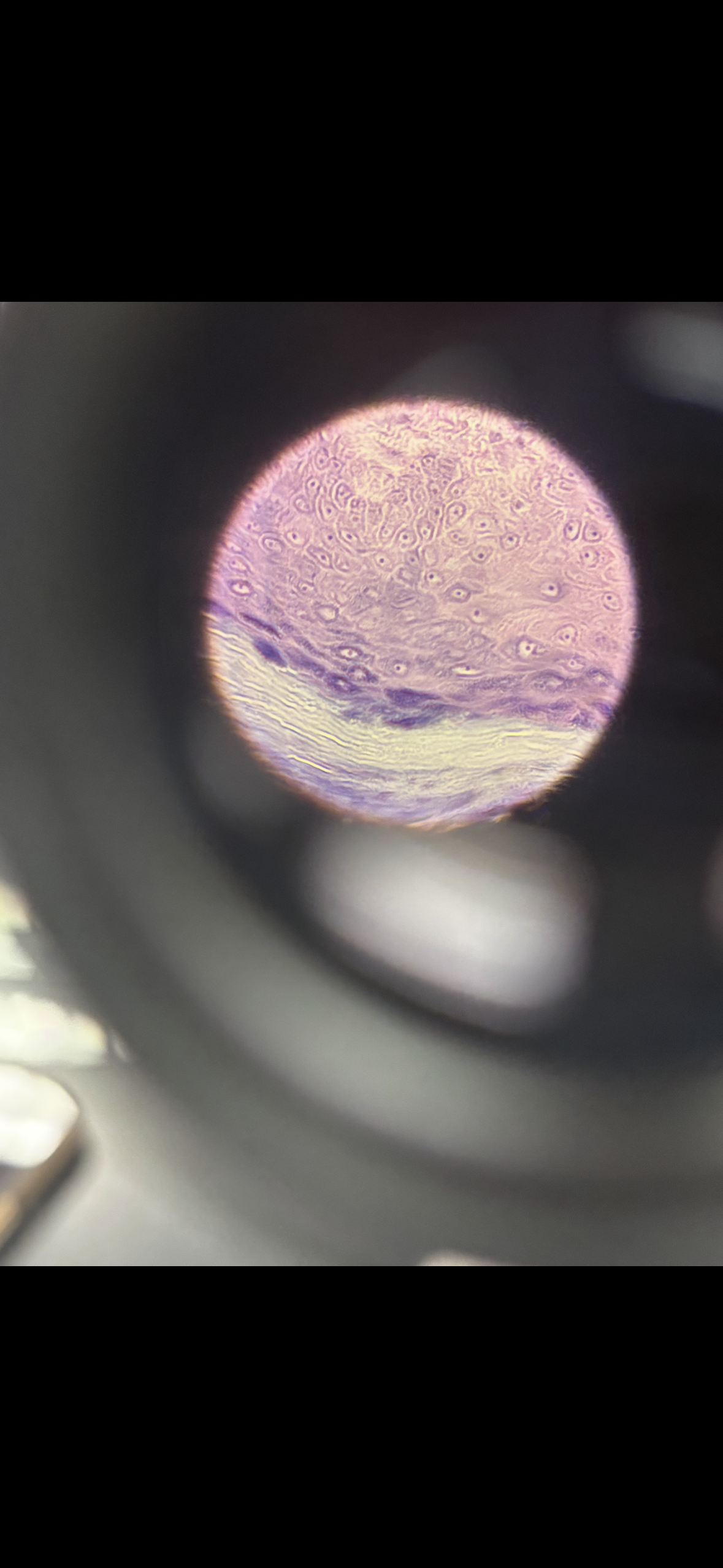 <p>Body location: lining the vagina</p>