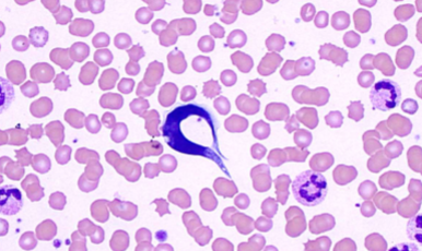 <p>What does Trypanosoma cruzi infect</p>