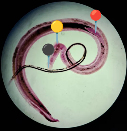 <p><span data-name="worm" data-type="emoji">🪱</span><span data-name="flag_jp" data-type="emoji">🇯🇵</span><span><span> </span></span><strong><em>Schistosoma japonicum </em></strong><sub>(Postać dojrzała)</sub></p><p></p><p></p><p><span>🧩🦠 </span><strong>Organelle:</strong></p><p></p><ul><li><p><span>⚫️ - przyssawka gębowa;</span></p></li></ul><p></p><ul><li><p><span>🟡 - przyssawka brzuszna;</span></p></li></ul><p></p><ul><li><p><span>🔴 - rynienka.</span></p></li></ul><p></p><p></p><p><span>😷❓ </span><strong>Parazytoza:</strong><em> Schistosomoza przewodu pokarmowego</em></p>