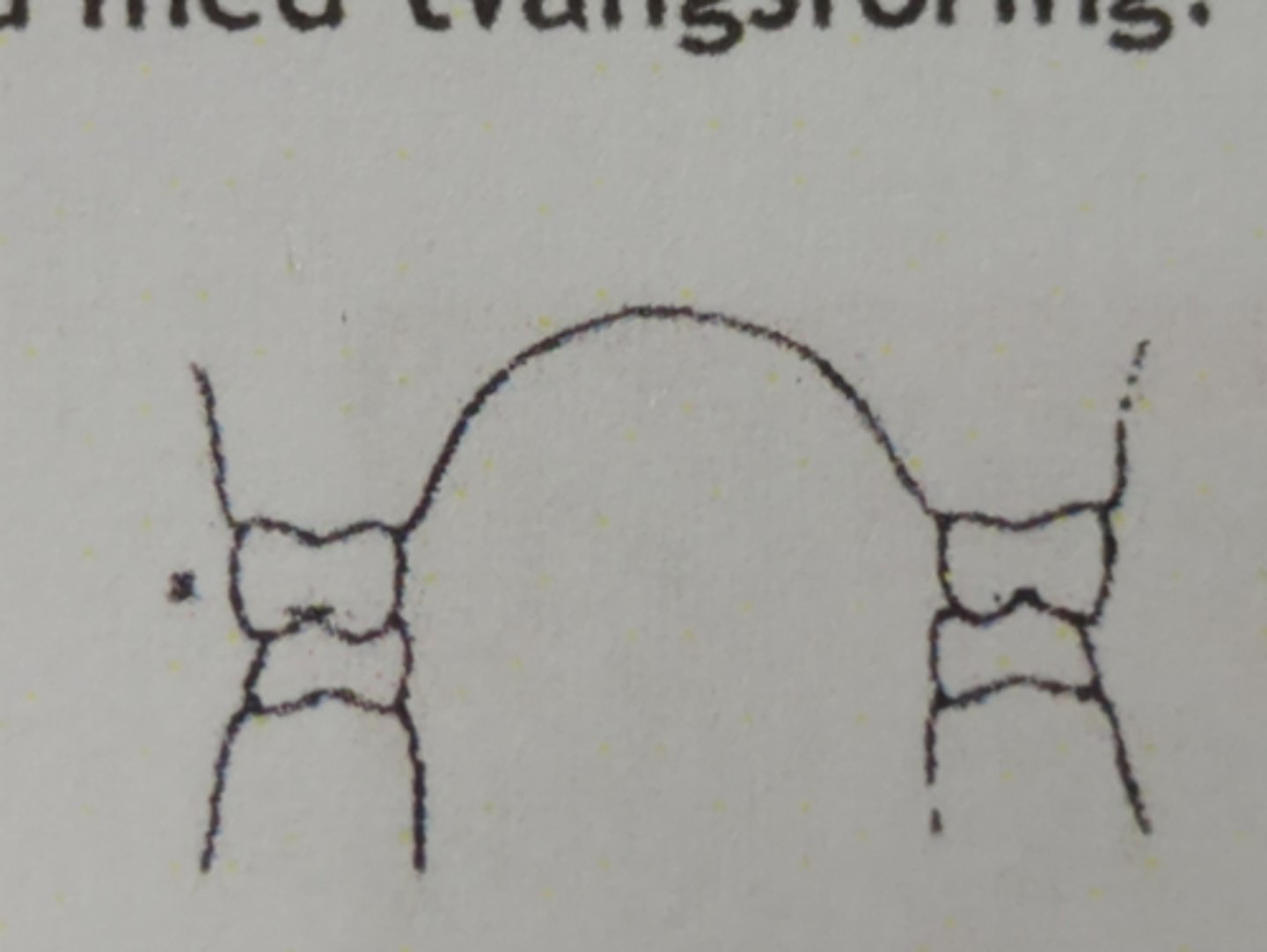 <p>Buckala kusparna i uk ockluderar mot centrala fossan i ök och palatinala kusparna i ök ockluderar mot centrala fossan i uk</p>