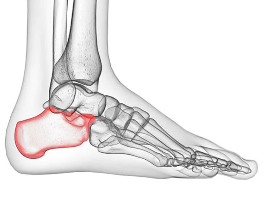 <p>Bone of the tarsus which constitutes the heel in primates and the hock in some other species.</p>