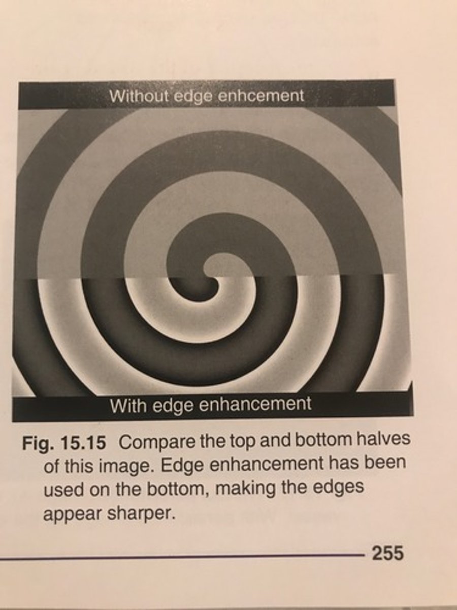 <p>A post-processing technique that improves visibility of small, high-contrast structures</p>