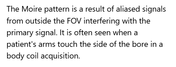 <p>A. Interference of aliased signals at different phases</p>