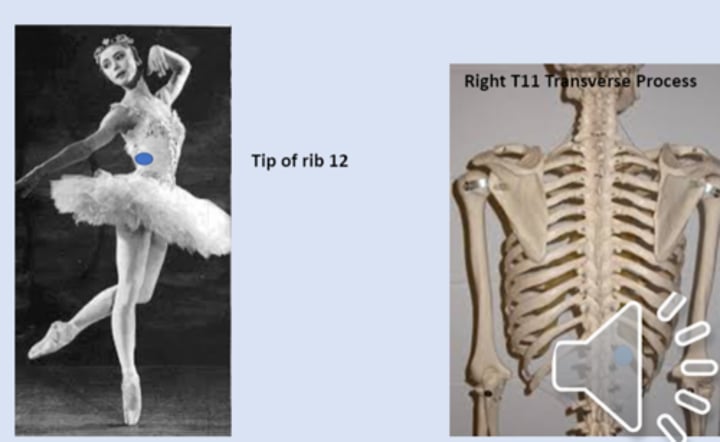 <p>anterior point: tip of 12th rib<br>posterior point: right T11 transverse process</p>