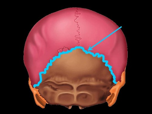 <p>joins parietal and occipital bones</p>