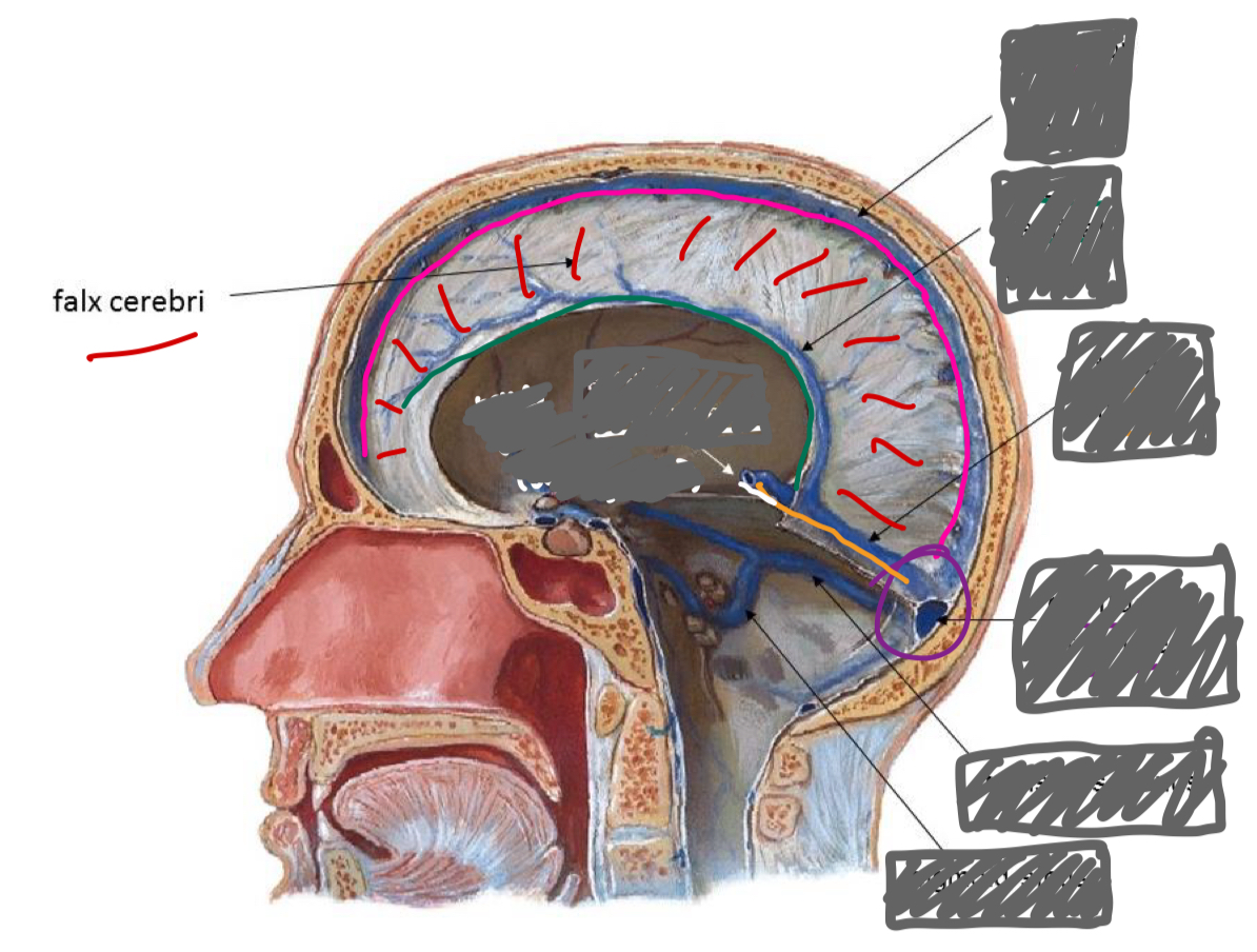 <p>label the sinuses (and vein)</p>