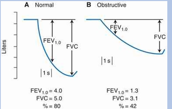 <p>-obstruction is consequence of airway compression during expiration</p><p>-effect is exacerbated during a forceful expiratory maneuver done during spirometry</p>