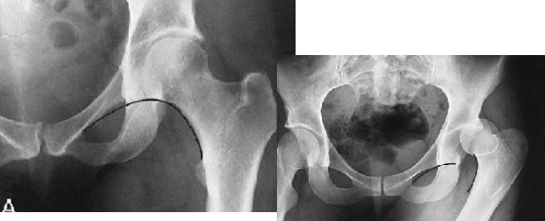 <p>Q what is the name of this measurement? and what is the average + range?</p>
