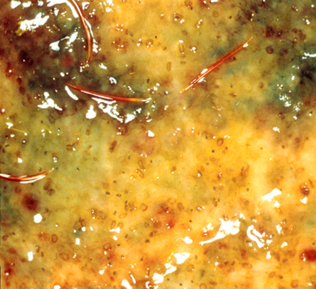 <p>What parasite group, encysted in the colonic wall of the necropsied pony, is associated with this image?</p>