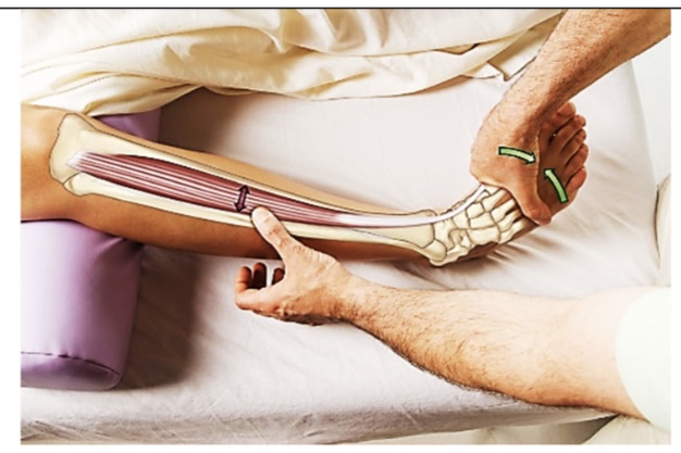 <p>tibialis anterior</p>